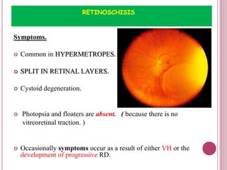 Retinal Splitting RETINAL DETACHMENT | PPTX