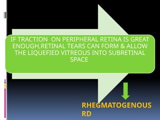 IF TRACTION ON PERIPHERAL RETINA IS GREAT
ENOUGH,RETINAL TEARS CAN FORM & ALLOW
THE LIQUEFIED VITREOUS INTO SUBRETINAL
SPACE
RHEGMATOGENOUS
RD
 