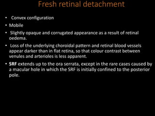 Fresh retinal detachment
• Convex configuration
• Mobile
• Slightly opaque and corrugated appearance as a result of retinal
oedema.
• Loss of the underlying choroidal pattern and retinal blood vessels
appear darker than in flat retina, so that colour contrast between
venules and arterioles is less apparent.
• SRF extends up to the ora serrata, except in the rare cases caused by
a macular hole in which the SRF is initially confined to the posterior
pole.
 