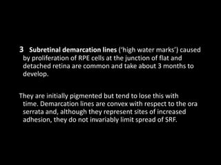 3 Subretinal demarcation lines (‘high water marks’) caused
by proliferation of RPE cells at the junction of flat and
detached retina are common and take about 3 months to
develop.
They are initially pigmented but tend to lose this with
time. Demarcation lines are convex with respect to the ora
serrata and, although they represent sites of increased
adhesion, they do not invariably limit spread of SRF.
 