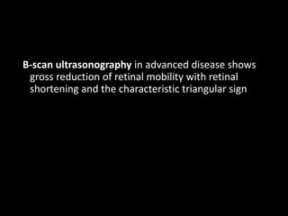 B-scan ultrasonography in advanced disease shows
gross reduction of retinal mobility with retinal
shortening and the characteristic triangular sign
 