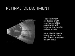 RETINAL DETACHMENT
The detachment
produces a bright
continuous, folded
appearance with
insertion into the disc
and ora serrata.
It is to determine the
configuration of the
detachment as shallow,
flat or bullous
 