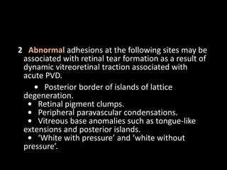 2 Abnormal adhesions at the following sites may be
associated with retinal tear formation as a result of
dynamic vitreoretinal traction associated with
acute PVD.
• Posterior border of islands of lattice
degeneration.
• Retinal pigment clumps.
• Peripheral paravascular condensations.
• Vitreous base anomalies such as tongue-like
extensions and posterior islands.
• ‘White with pressure’ and ‘white without
pressure’.
 
