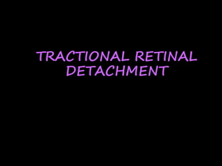 TRACTIONAL RETINAL
DETACHMENT
 