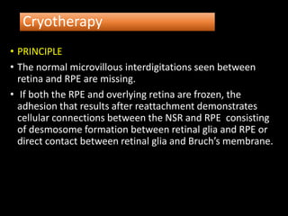 Cryotherapy
• PRINCIPLE
• The normal microvillous interdigitations seen between
retina and RPE are missing.
• If both the RPE and overlying retina are frozen, the
adhesion that results after reattachment demonstrates
cellular connections between the NSR and RPE consisting
of desmosome formation between retinal glia and RPE or
direct contact between retinal glia and Bruch’s membrane.
 