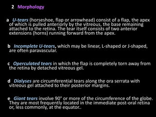 2 Morphology
a U-tears (horseshoe, flap or arrowhead) consist of a flap, the apex
of which is pulled anteriorly by the vitreous, the base remaining
attached to the retina. The tear itself consists of two anterior
extensions (horns) running forward from the apex.
b Incomplete U-tears, which may be linear, L-shaped or J-shaped,
are often paravascular.
c Operculated tears in which the flap is completely torn away from
the retina by detached vitreous gel.
d Dialyses are circumferential tears along the ora serrata with
vitreous gel attached to their posterior margins.
e Giant tears involve 90° or more of the circumference of the globe.
They are most frequently located in the immediate post-oral retina
or, less commonly, at the equator..
 
