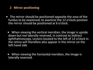 2 Mirror positioning
• The mirror should be positioned opposite the area of the
fundus to be examined; to examine the 12 o’clock position
the mirror should be positioned at 6 o’clock.
• When viewing the vertical meridian, the image is upside
down but not laterally reversed, in contrast to indirect
ophthalmoscopy. Lesions located to the left of 12 o’clock in
the retina will therefore also appear in the mirror on the
left-hand side
• When viewing the horizontal meridian, the image is
laterally reversed.
 