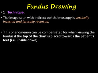 Fundus Drawing
• 1 Technique.
• The image seen with indirect ophthalmoscopy is vertically
inverted and laterally reversed.
• This phenomenon can be compensated for when viewing the
fundus if the top of the chart is placed towards the patient's
feet (i.e. upside down).
 