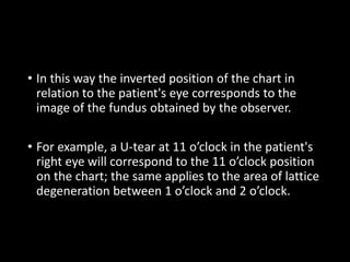 • In this way the inverted position of the chart in
relation to the patient's eye corresponds to the
image of the fundus obtained by the observer.
• For example, a U-tear at 11 o’clock in the patient's
right eye will correspond to the 11 o’clock position
on the chart; the same applies to the area of lattice
degeneration between 1 o’clock and 2 o’clock.
 