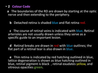 • 2 Colour Code
a The boundaries of the RD are drawn by starting at the optic
nerve and then extending to the periphery.
b Detached retina is shaded blue and flat retina red.
c The course of retinal veins is indicated with blue. Retinal
arterioles are not usually drawn unless they serve as a
specific guide to an important lesion.
d Retinal breaks are drawn in red with blue outlines; the
flat part of a retinal tear is also drawn in blue.
e Thin retina is indicated by red hatching outlined in blue,
lattice degeneration is shown as blue hatching outlined in
blue, retinal pigment is blackk, retinal exudates yellow, and
vitreous opacities green.
 
