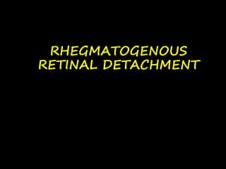 RHEGMATOGENOUS
RETINAL DETACHMENT
 