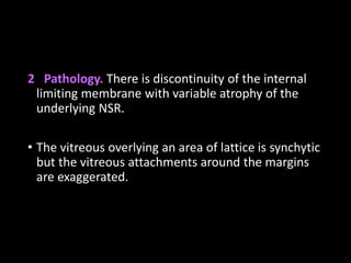 2 Pathology. There is discontinuity of the internal
limiting membrane with variable atrophy of the
underlying NSR.
• The vitreous overlying an area of lattice is synchytic
but the vitreous attachments around the margins
are exaggerated.
 