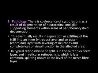 2 Pathology. There is coalescence of cystic lesions as a
result of degeneration of neuroretinal and glial
supporting elements within areas of peripheral cystoid
degeneration.
• This eventually results in separation or splitting of the
NSR into an inner (vitreous) layer and an outer
(choroidal) layer with severing of neurones and
complete loss of visual function in the affected area.
• In typical retinoschisis the split is in the outer plexiform
layer, and in reticular retinoschisis, which is less
common, splitting occurs at the level of the nerve fibre
layer.
 