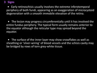 3 Signs
• Early retinoschisis usually involves the extreme inferotemporal
periphery of both fundi, appearing as an exaggeration of microcystoid
degeneration with a smooth immobile elevation of the retina.
• The lesion may progress circumferentially until it has involved the
entire fundus periphery. The typical form usually remains anterior to
the equator although the reticular type may spread beyond the
equator.
• The surface of the inner layer may show snowflakes as well as
sheathing or ‘silver-wiring’ of blood vessels and the schisis cavity may
be bridged by rows of torn grey-white tissue.
 