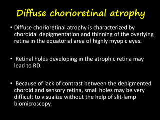 Diffuse chorioretinal atrophy
• Diffuse chorioretinal atrophy is characterized by
choroidal depigmentation and thinning of the overlying
retina in the equatorial area of highly myopic eyes.
• Retinal holes developing in the atrophic retina may
lead to RD.
• Because of lack of contrast between the depigmented
choroid and sensory retina, small holes may be very
difficult to visualize without the help of slit-lamp
biomicroscopy.
 