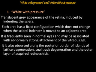 White withpressure’ and ‘whitewithout pressure’
1 ‘White with pressure’
Translucent grey appearance of the retina, induced by
indenting the sclera.
Each area has a fixed configuration which does not change
when the scleral indenter is moved to an adjacent area.
It is frequently seen in normal eyes and may be associated
with abnormally strong attachment of the vitreous gel.
It is also observed along the posterior border of islands of
lattice degeneration, snailtrack degeneration and the outer
layer of acquired retinoschisis.
 