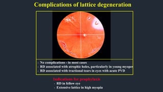 Complications of lattice degeneration
Indications for prophylaxis
• No complications - in most cases
• RD associated with atrophic holes, particularly in young myopes
• RD associated with tractional tears in eyes with acute PVD
• RD in fellow eye
• Extensive lattice in high myopia
 