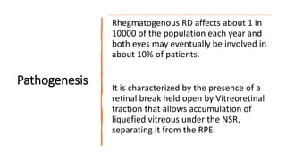 Pathogenesis
Rhegmatogenous RD affects about 1 in
10000 of the population each year and
both eyes may eventually be involved in
about 10% of patients.
It is characterized by the presence of a
retinal break held open by Vitreoretinal
traction that allows accumulation of
liquefied vitreous under the NSR,
separating it from the RPE.
 