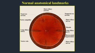 Normal anatomical landmarks
Short ciliary
arteries
Temporal ora
serrata
Short ciliary
nerves
Macula
Long ciliary
nerve
Short ciliary
nerves
Microcystoid
degeneration
Nasal ora
serrata
Vortex ampullae
Long ciliary
artery
Vortex vein
 