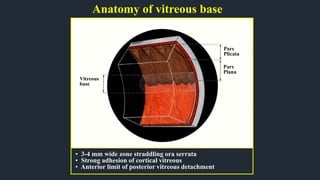 Anatomy of vitreous base
• 3-4 mm wide zone straddling ora serrata
• Strong adhesion of cortical vitreous
• Anterior limit of posterior vitreous detachment
Vitreous
base
Pars
Plicata
Pars
Plana
 