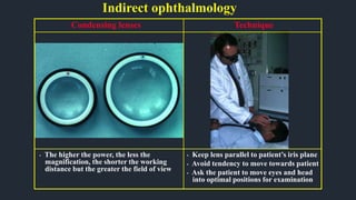 Indirect ophthalmology
• Keep lens parallel to patient’s iris plane
• Avoid tendency to move towards patient
• Ask the patient to move eyes and head
into optimal positions for examination
Technique
• The higher the power, the less the
magnification, the shorter the working
distance but the greater the field of view
Condensing lenses
 