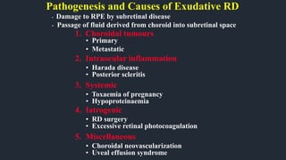Pathogenesis and Causes of Exudative RD
• Damage to RPE by subretinal disease
• Passage of fluid derived from choroid into subretinal space
1. Choroidal tumours
• Primary
• Metastatic
2. Intraocular inflammation
• Harada disease
• Posterior scleritis
3. Systemic
• Toxaemia of pregnancy
• Hypoproteinaemia
4. Iatrogenic
• RD surgery
• Excessive retinal photocoagulation
5. Miscellaneous
• Choroidal neovascularization
• Uveal effusion syndrome
 
