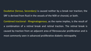 Exudative (Serous, Secondary) is caused neither by a break nor traction; the
SRF is derived from fluid in the vessels of the NSR or choroid, or both.
Combined tractional - Rhegmatogenous, as the name implies, is the result of
a combination of a retinal break and retinal traction. The retinal break is
caused by traction from an adjacent area of fibrovascular proliferation and is
most commonly seen in advanced proliferative diabetic retinopathy
 