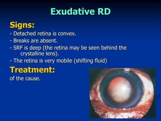 Retinal Detachment for medical students | PPT