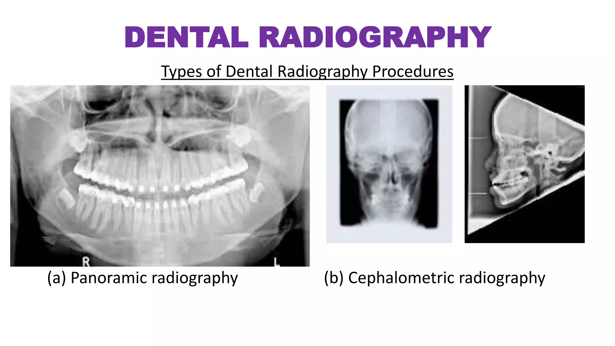 rdg4011stsem-dentalradiography-180219135013.pdf