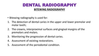 Bitewing Radiography Pdf rdg4011stsem-dentalradiography-180219135013.pdf
