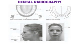 rdg4011stsem-dentalradiography-180219135013.pdf