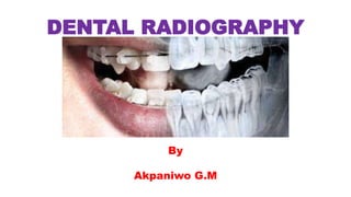 DENTAL RADIOGRAPHY
By
Akpaniwo G.M
 