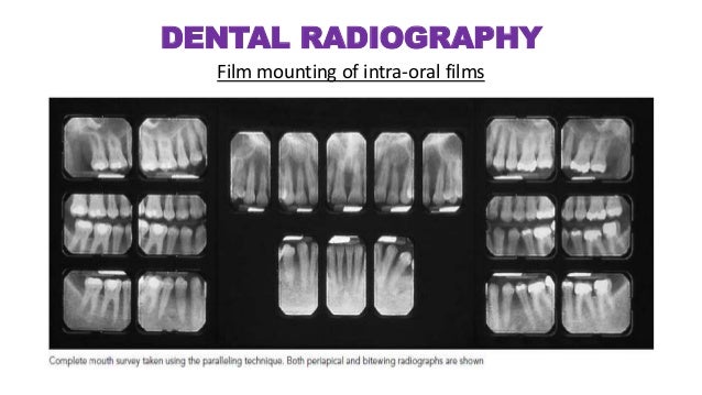 Dental Radiography