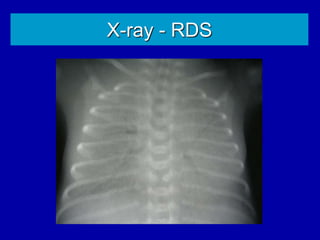 X-ray - RDS
 