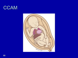 CCAM
83
 