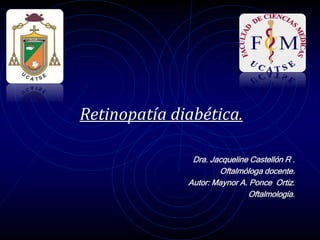 Retinopatía diabética.
Dra. Jacqueline Castellón R .
Oftalmóloga docente.
Autor: Maynor A. Ponce Ortiz.
Oftalmología.
 