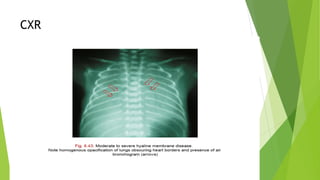 CXR
 