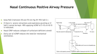 Nasal Continuous Positive Airway Pressure
u keep PaO 2 between 50 and 70 mm Hg (91–95% SaO 2 )
u If there is severe retractions and expiratory grunting or if
SaO 2 cannot be kept >90% applying nCPAP at 5-10 cm H2 O
is indicated.
u Nasal CPAP reduces collapse of surfactant-deficient alveoli
u Early use of nCPAP reduces the need for mechanical
ventilation.
 