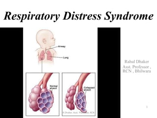 Respiratory Distress Syndrome
Rahul Dhaker
Asst. Professor ,
RCN , Bhilwara
1
R Dhaker, Asst. Professor, RCN
 