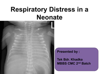 Respiratory Distress in a
Neonate
Presented by :
Tek Bdr. Khadka
MBBS CMC 2nd Batch
 