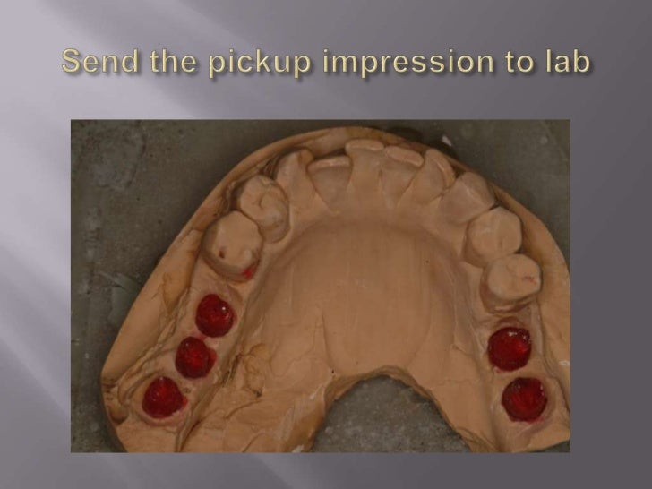 Dental Lab In Long Island Ny Dental Lab In Long Island Ny