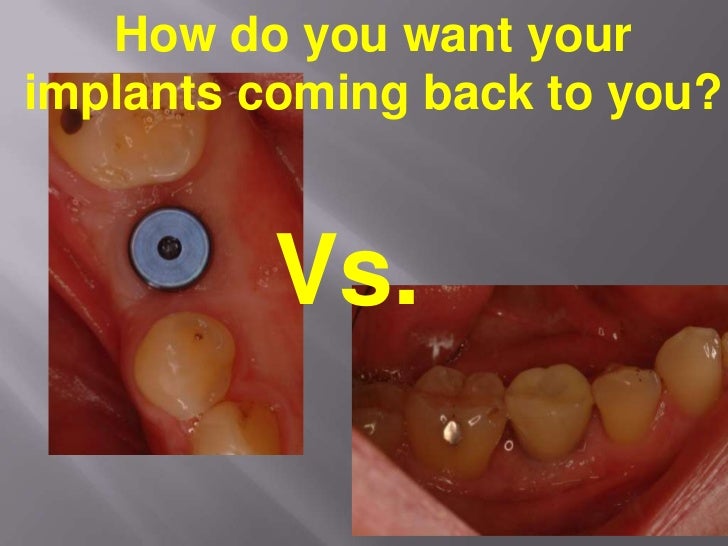 long-island-dental-implant-specialist-presents-restorative-benefits-of-using-a-restorative-driven-surgical-practice-2-728.jpg?cb=1288907430