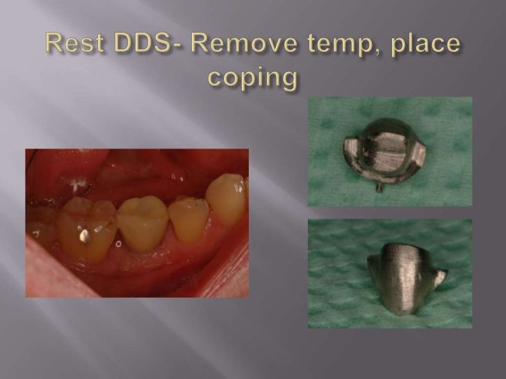long-island-dental-implant-specialist-presents-restorative-benefits-of-using-a-restorative-driven-surgical-practice-4-728.jpg?cb=1288907430