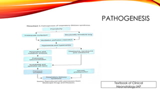 Pathophysiology For Rds Respiratory Distress Syndrome(RDS) in neonates | PPTX