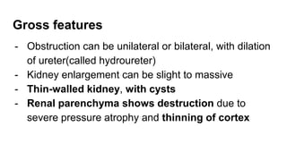 Gross features
- Obstruction can be unilateral or bilateral, with dilation
of ureter(called hydroureter)
- Kidney enlargement can be slight to massive
- Thin-walled kidney, with cysts
- Renal parenchyma shows destruction due to
severe pressure atrophy and thinning of cortex
 