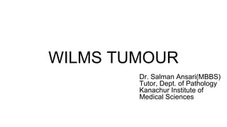 WILMS TUMOUR
Dr. Salman Ansari(MBBS)
Tutor, Dept. of Pathology
Kanachur Institute of
Medical Sciences
 