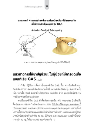 32การใช้ยาสมเหตุผลในร้านยา
แผนภาพที่ 4 แสดงตำ�แหน่งของต่อมน้ำ�เหลืองที่มีการบวมโต
เมื่อมีการติดเชื้อแบคทีเรีย GAS
Anterior Cervical Adenopathy
ภาพจาก https://th.wikipedia.org/wiki/ ซึ่งอนุญาตให้นำ�ไปใช้ต่อได้
แนวทางการให้ยาปฏิชีวนะ ในผู้ป่วยที่มีการติดเชื้อ
แบคทีเรีย GAS(1,2,3)
การให้ยาปฏิชีวนะเพื่อฆ่าเชื้อแบคทีเรีย GAS นั้น ควรเริ่มต้นด้วยยา
Penicillin หรือยา Amoxicillin ในขนาดต่ำ�ได้ (amoxicillin 500 mg. วันละ 2 ครั้ง)
เนื่องจากเชื้อ GAS มีความไวต่อยากลุ่ม penicillin มาก และยังไม่มีรายงาน
การดื้อยาของเชื้อต่อ penicillin
พบเชื้อแบคทีเรีย GAS มักดื้อต่อยากลุ่มอื่น เช่น macrolide (ในอินเดีย
ดื้อประมาณ 68.4% ในไทยประมาณ 20%) จึงไม่ควรใช้ยากลุ่ม macrolide นี้
เป็นยาขนานแรก และไม่ควรเลือกยา clarithromycin/azithromycin เพราะเชื้อมี
โอกาสดื้อยามากกว่ากลุ่ม penicillin ถ้าจำ�เป็นอาจเลือกยา roxithromycin (ผู้ป่วย
น้ำ�หนักน้อยกว่าหรือเท่ากับ 40 kg. ให้ขนาด 5-8 mg/kg/day และถ้าน้ำ�หนัก
มากกว่า 40 kg. ให้ขนาด 300 mg วันละครั้ง) (1)
 