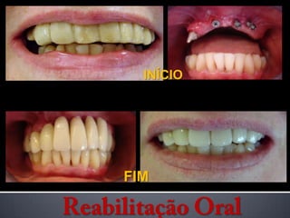 INÍCIO FIMReabilitação Oral
