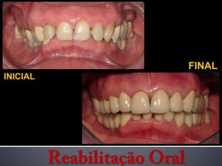 FINALINICIALReabilitação Oral