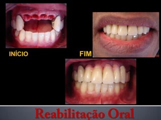 FIMINÍCIOReabilitação Oral